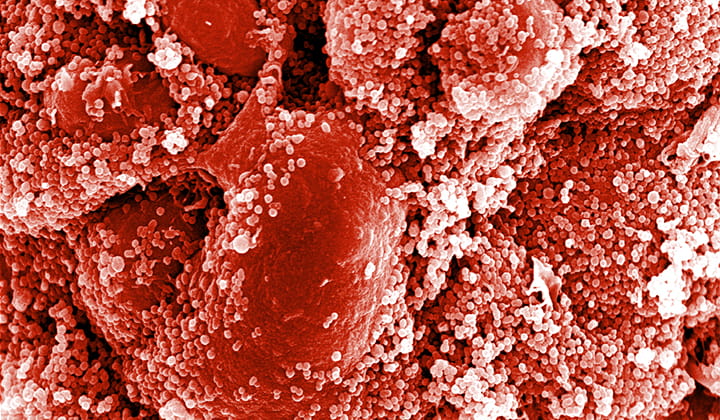 Cells under microscope.